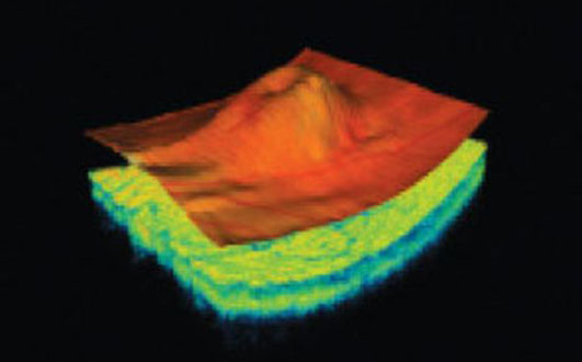 tomography-at-RJK-optometry-coffs-harbour